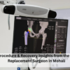 Best Hip Replacement Surgeon in Mohali