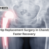 Hip Replacement Surgery in Chandigarh